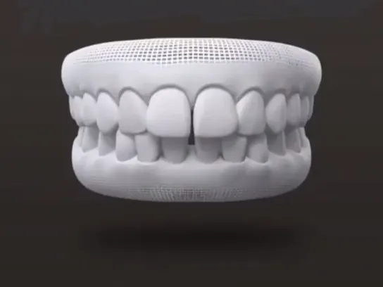 Escaneamento 3D de arcada dentária 2