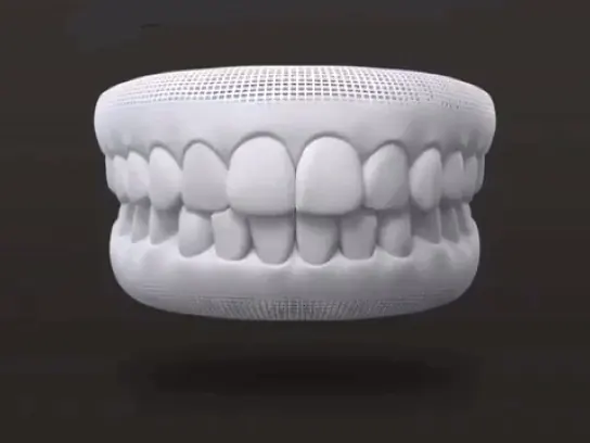 Escaneamento 3D de arcada dentária 1